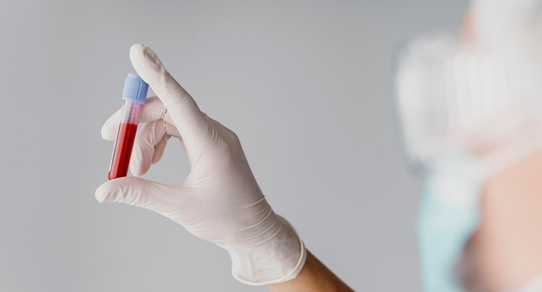 Hemoglobin Tinggi Bisa Jadi Tanda Kondisi Medis Serius